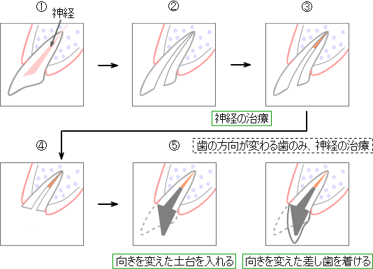 治療法2