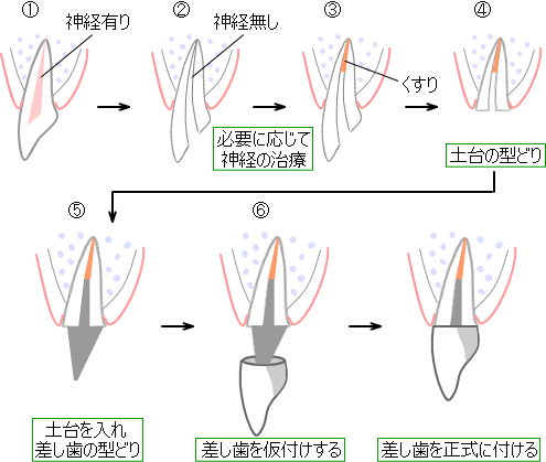 治療法