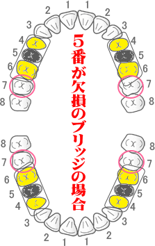 画像の説明