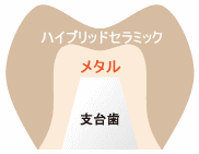 画像の説明 画像の説明